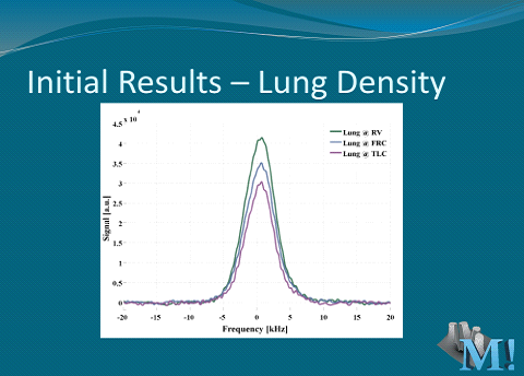 Lung Density Results